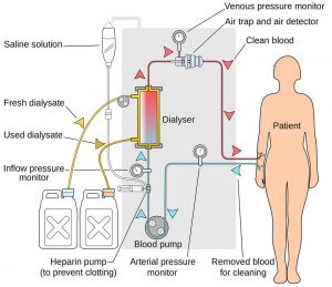 Kidney Dialysis Machine 